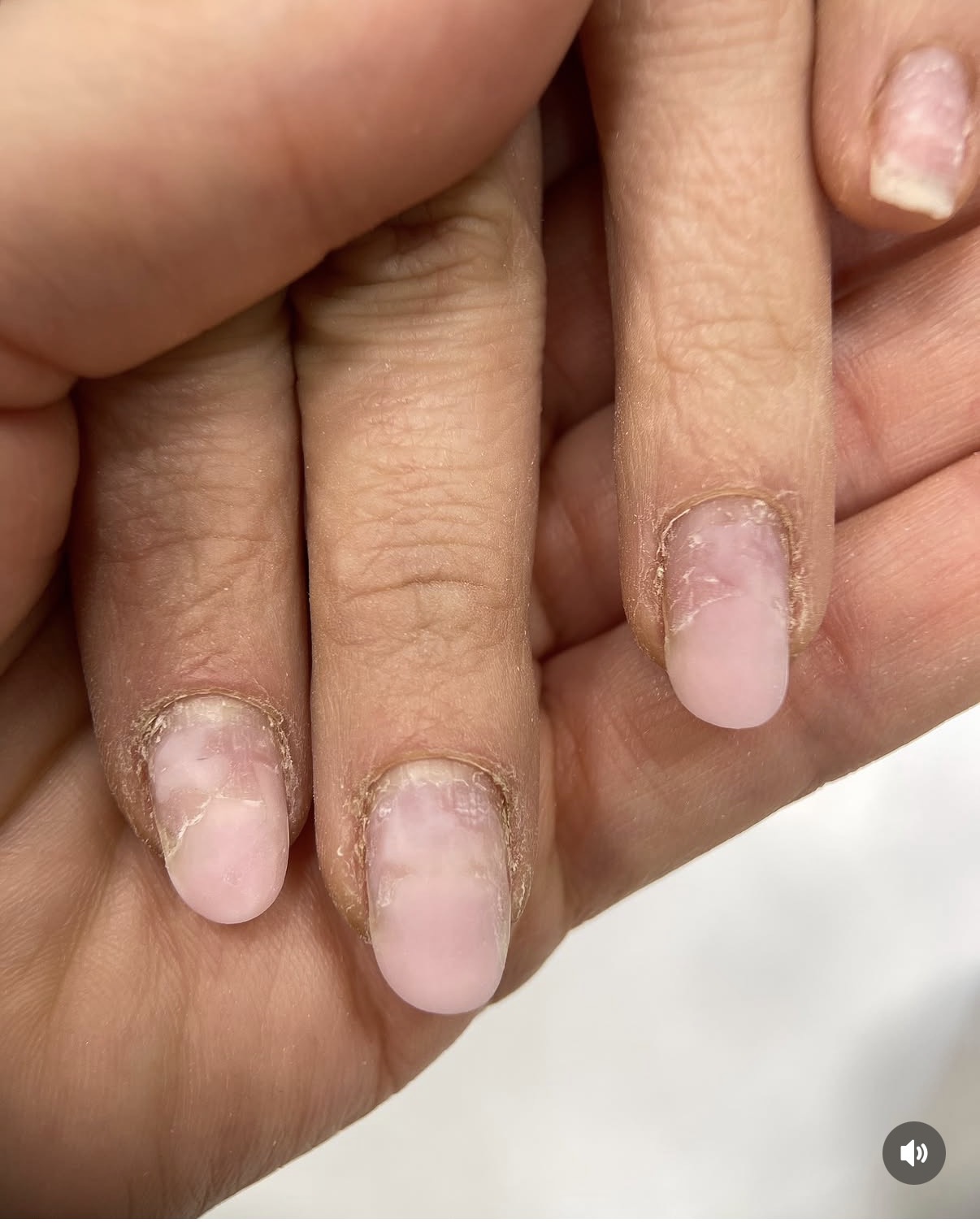 Ongles avant la manucure