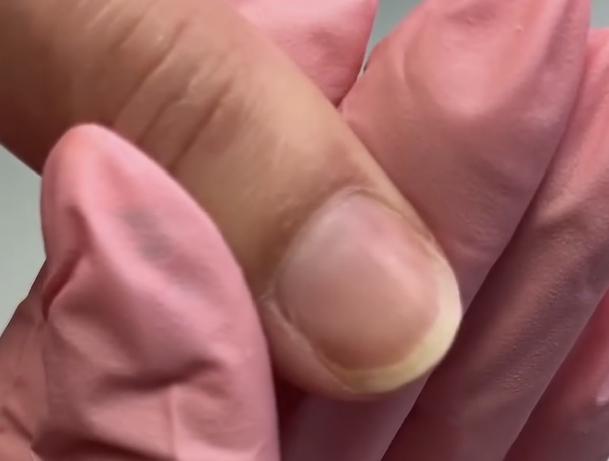 Ongles avant la manucure